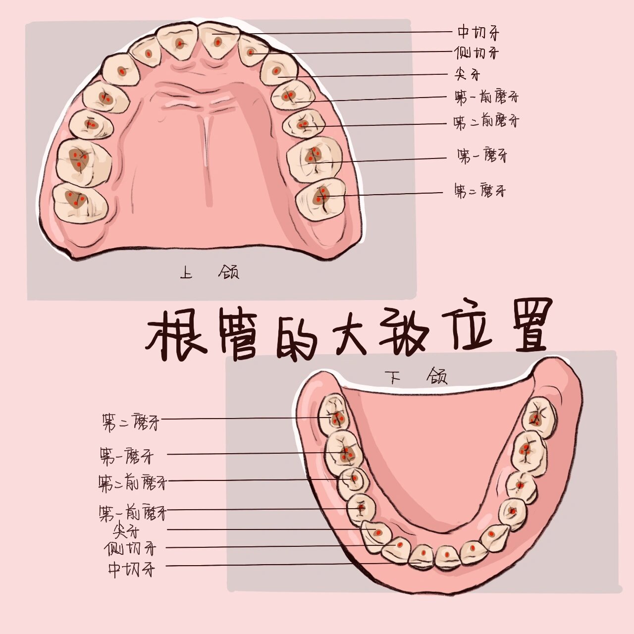 开髓位置图片