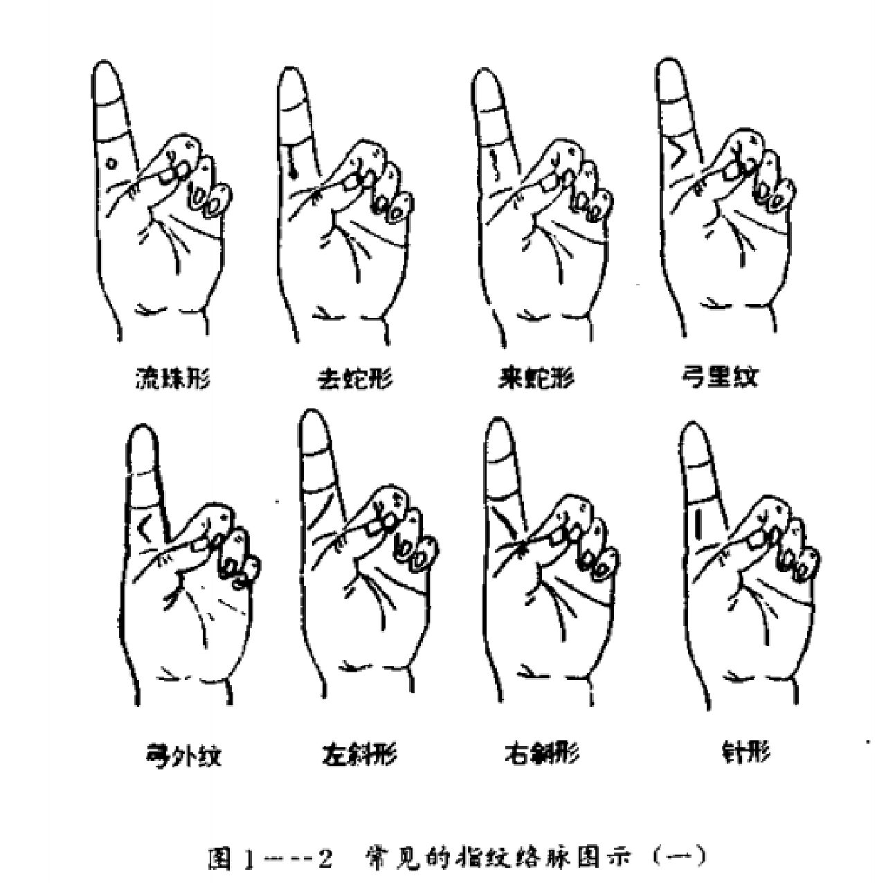0--3岁小儿指纹络脉诊病法 0--3岁小儿指纹络脉