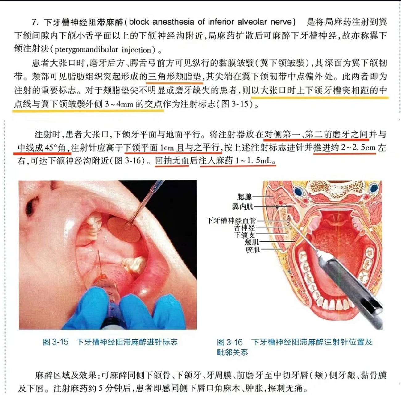 牙齿颊部的位置图片图片