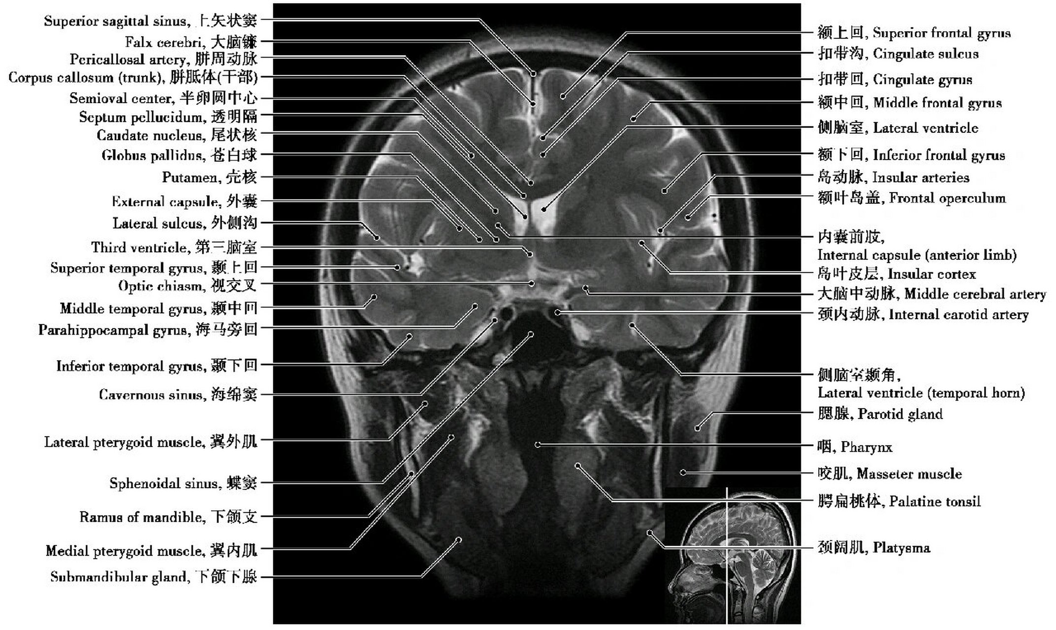 核磁共振内部结构图图片