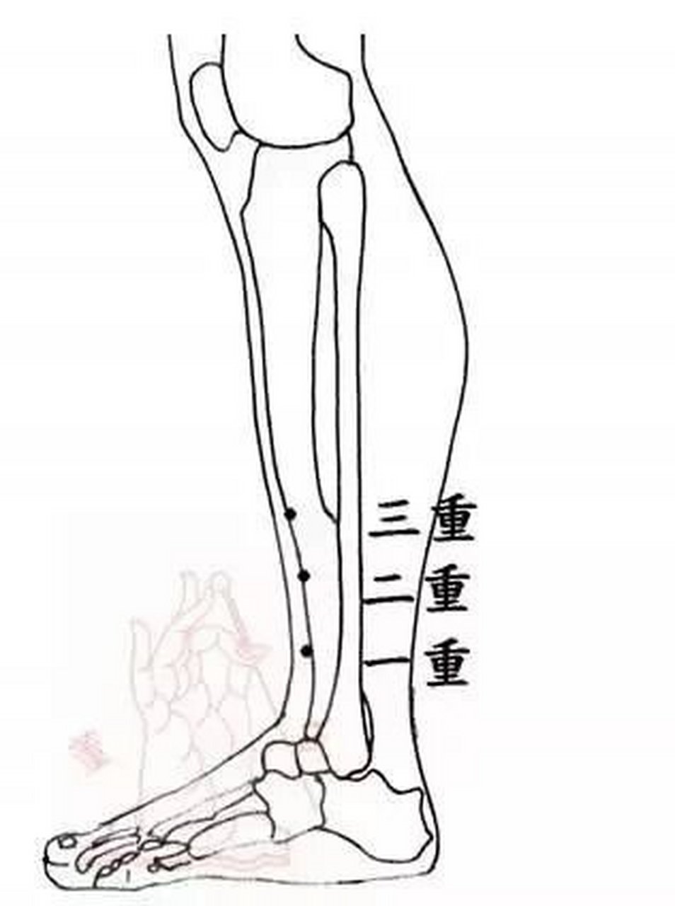 【董氏奇穴:顽固性便秘】 三重穴 一,足三重穴的分布 ①一重穴:足外踝