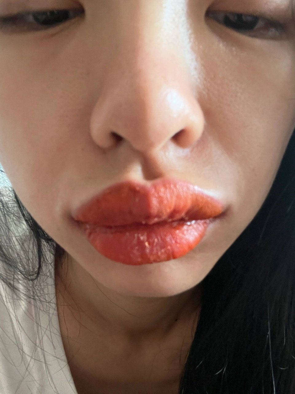救命啊98纹唇第二天 怎么没人告诉我会这样啊 我嘴巴怎么这么肿啊