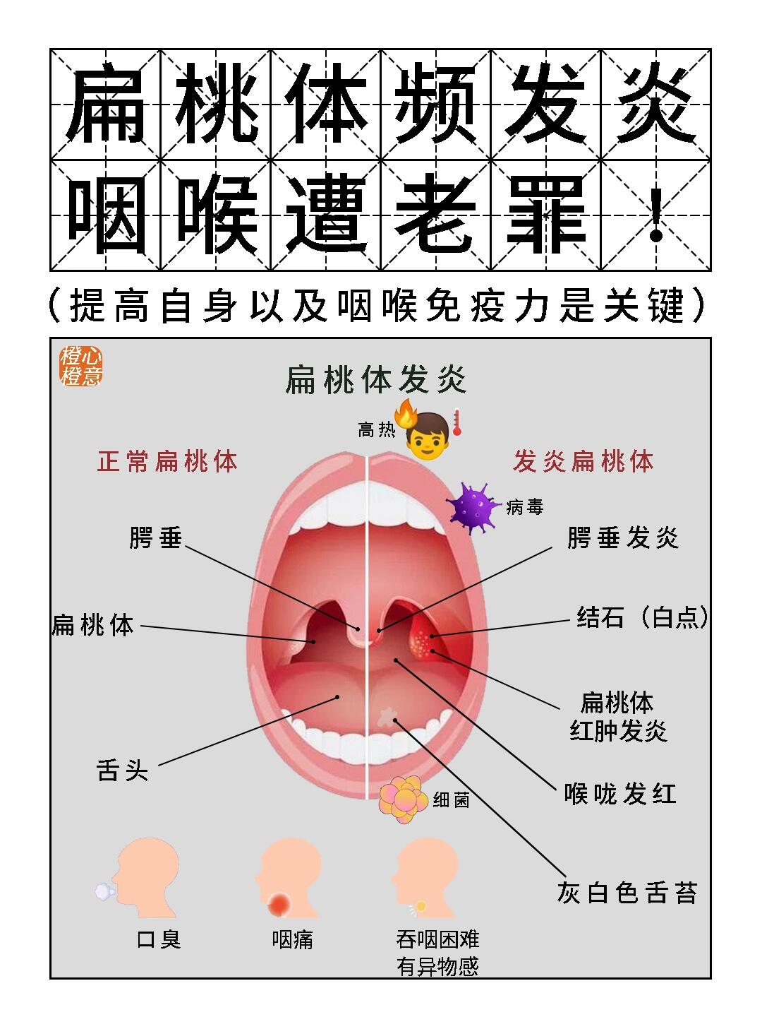 扁桃体为什么发炎图片