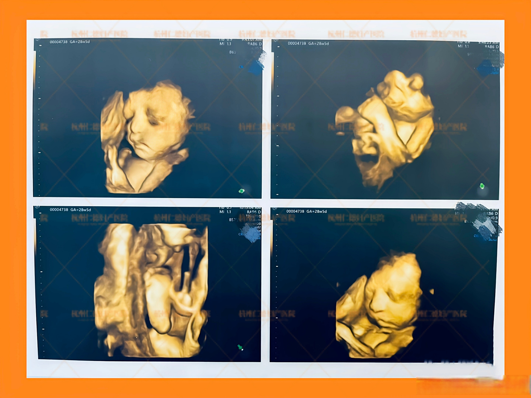 怀孕28周胎儿图片图片