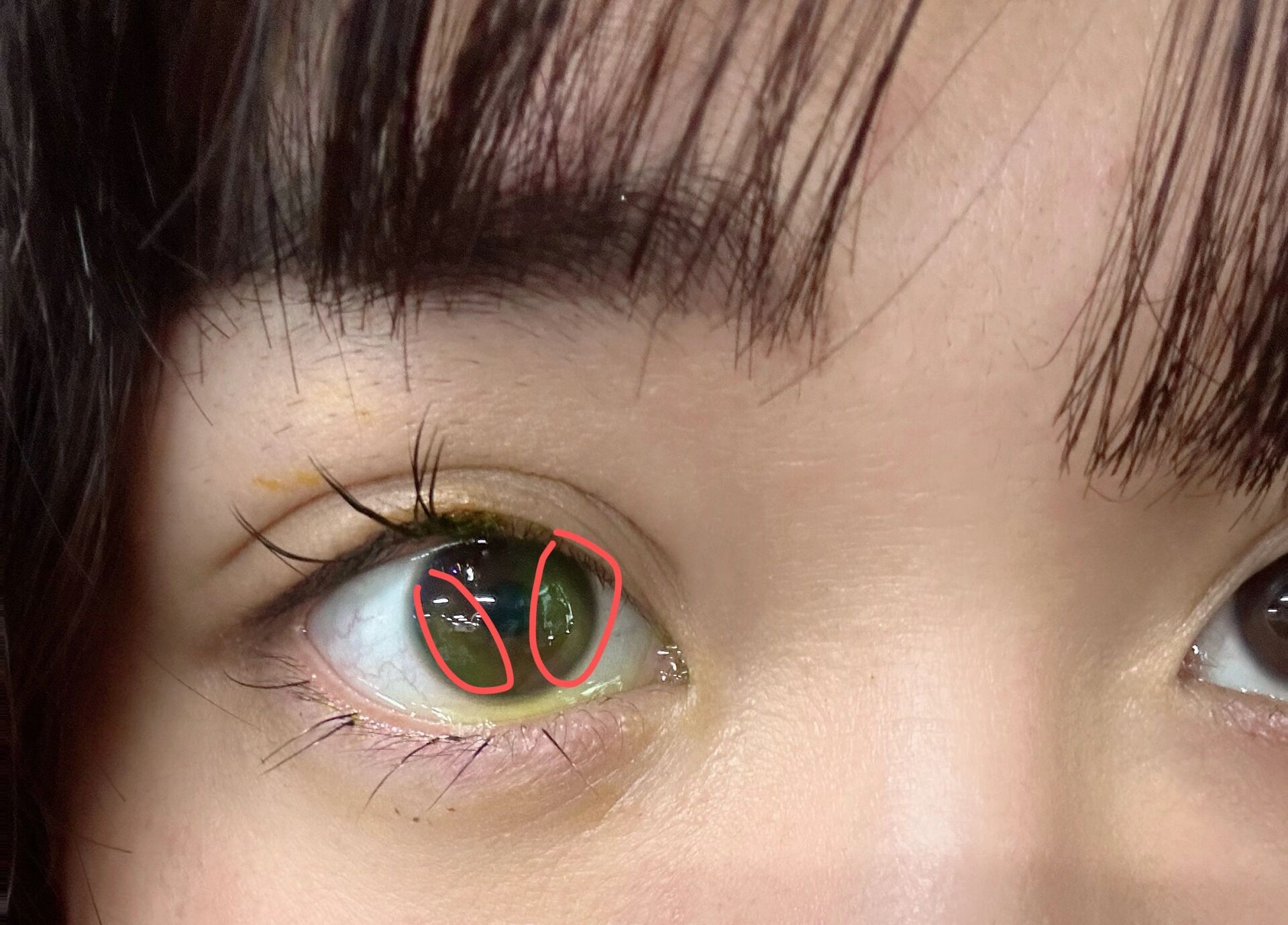 角膜破损也太疼了 胶水进眼睛里了,下回可不接睫毛了