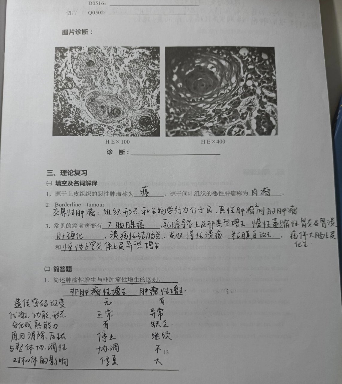 纤维肉瘤手绘图图片