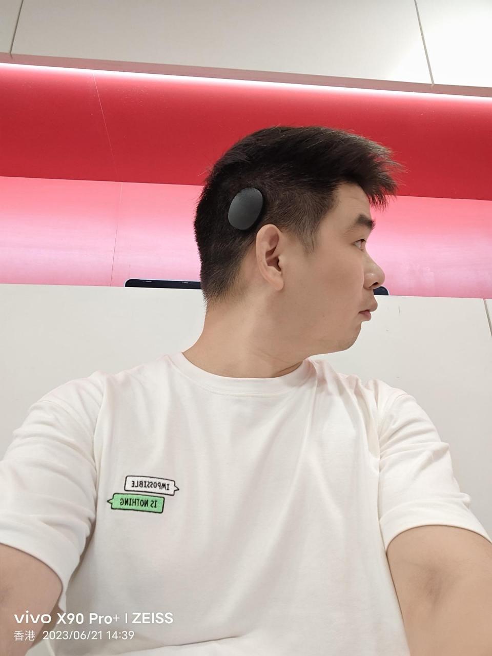 奥地利人工耳蜗rondo3一体机.