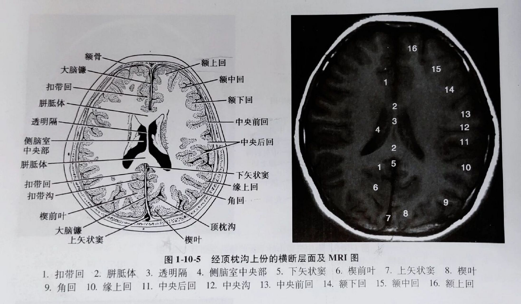 《头部的断面解剖及影像①》 1.经中央旁小叶上份的横断层面 2.