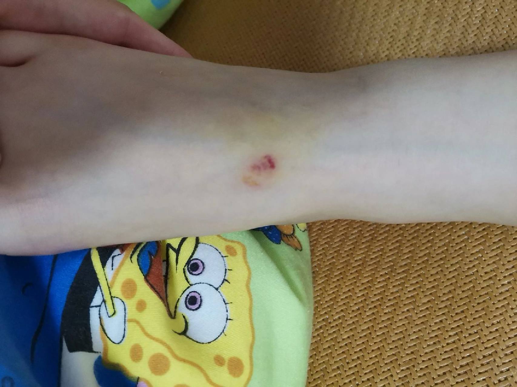 被兔子咬了,要打疫苗吗 邻居家的兔子,被孩子们天天当成宠物,颠来倒去