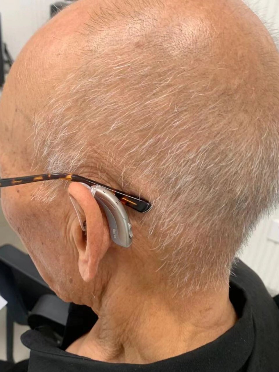 老年性耳聋是否需要佩戴助听器?