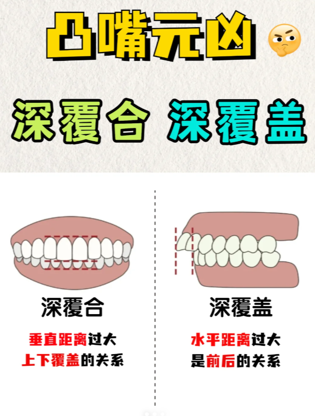 牙齿深覆合面相图片