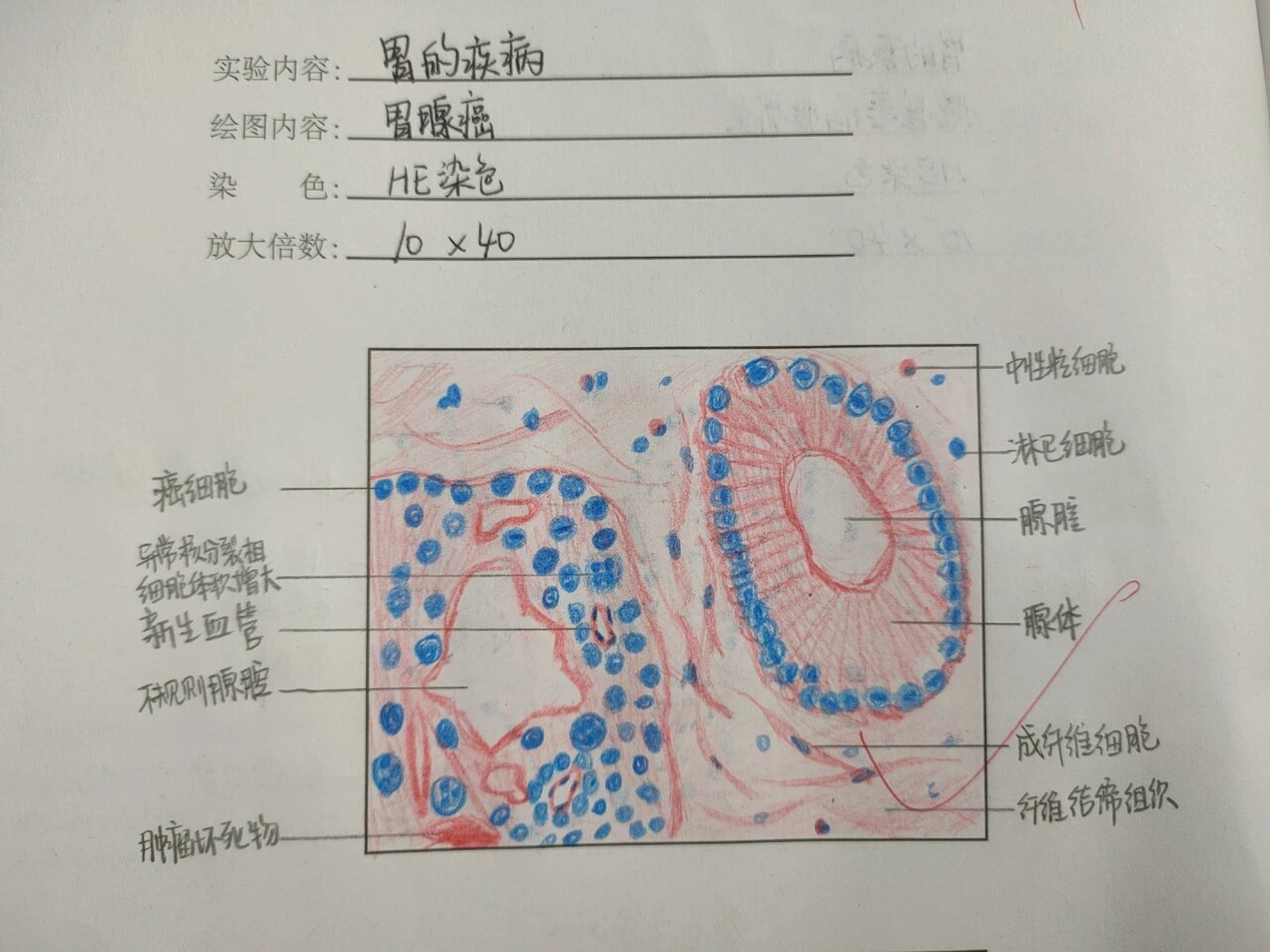 医学病理红蓝铅笔绘图 消化系统 1.消化腺-肝门管区 2.
