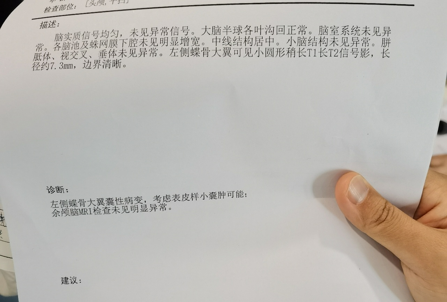 核磁共振结果,大家给看看?