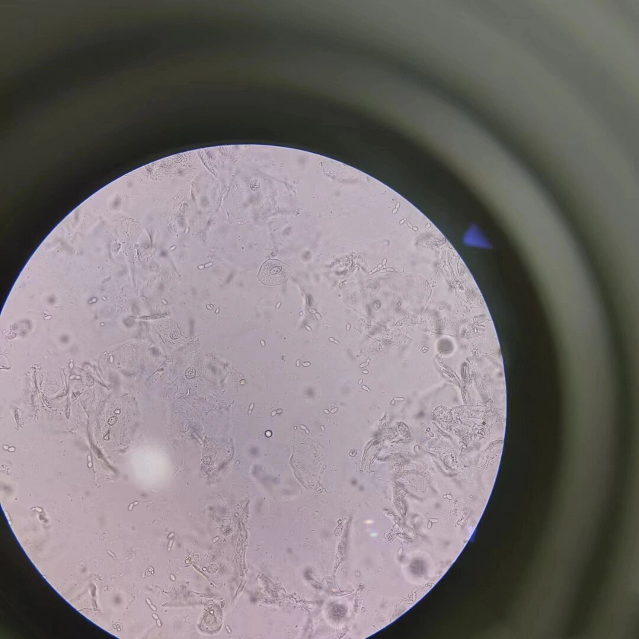 白带镜检~真菌孢子