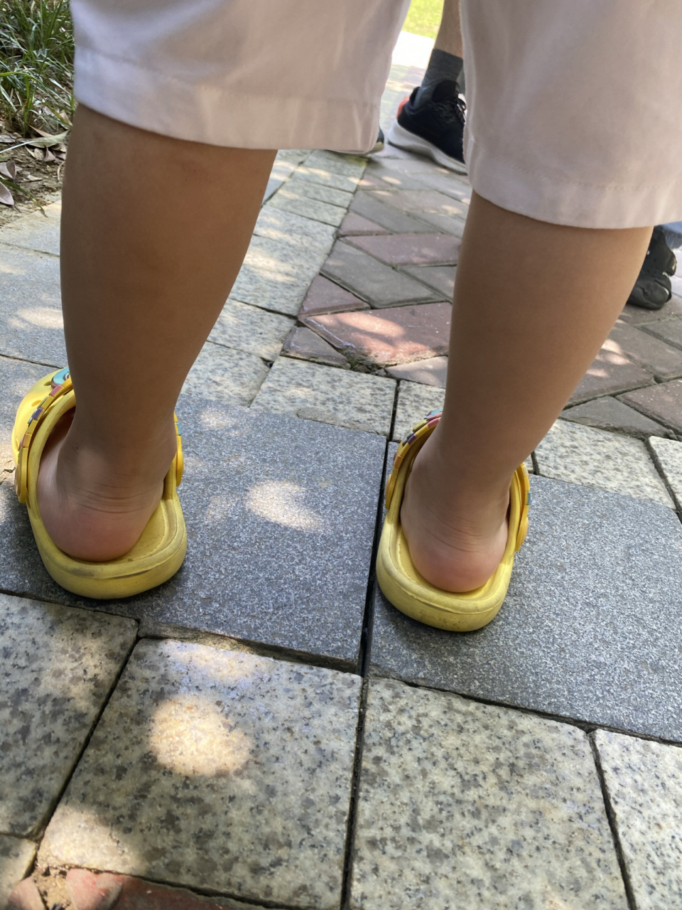 三岁宝宝足外翻扁平足怎么办宝妈们 宝宝刚三岁,以前没有注意这个问题