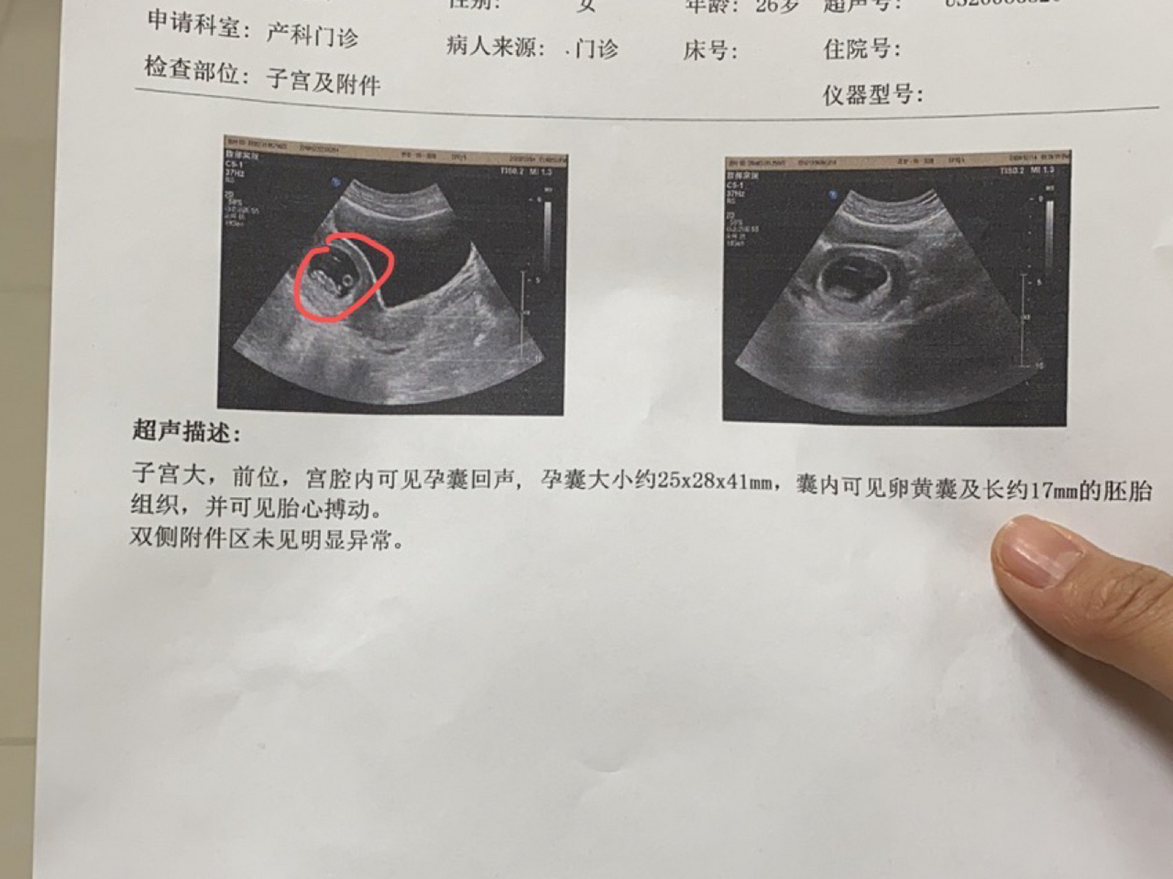 怀孕已经有11周了,今天睡觉的时候突然发现肚子里面动了两下,好像是