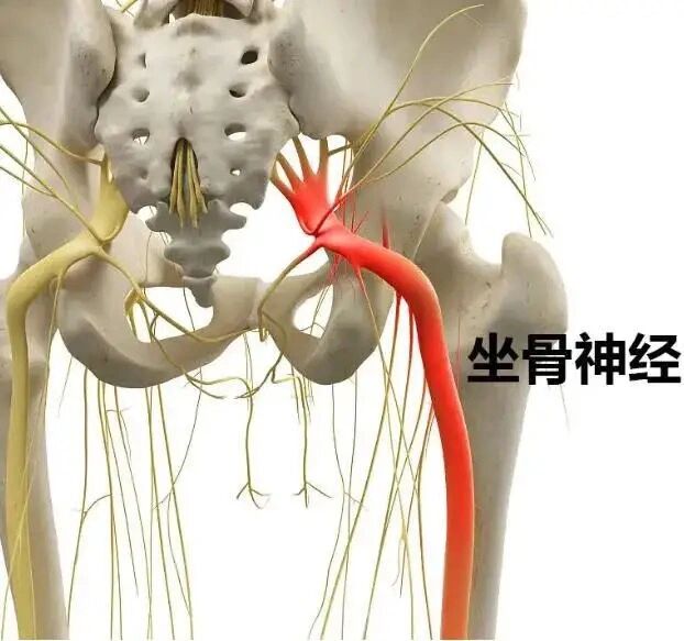 腰腿痛的元凶-梨状肌