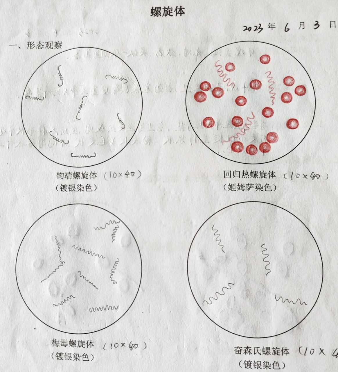 病原生物学与免疫学实验-绘图Ⅴ 钩端螺旋体 回归热螺旋体 梅毒螺旋体