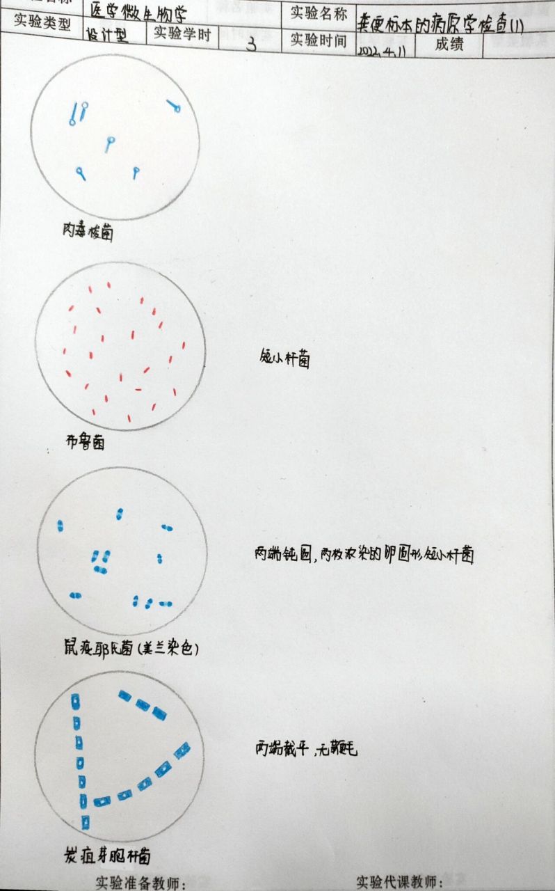 破伤风杆菌红蓝铅笔图片