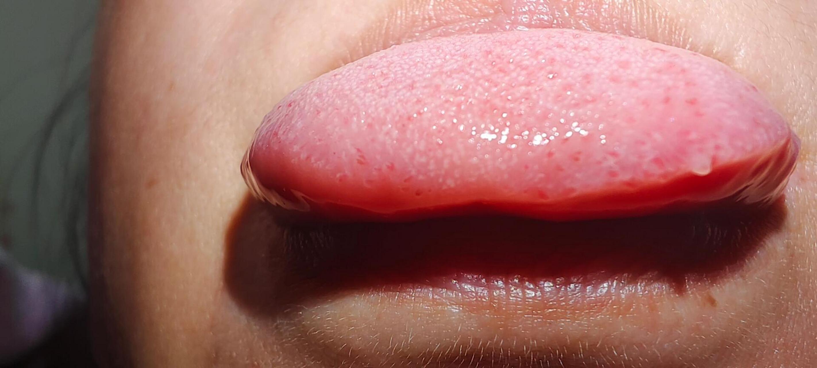 如果这个乳头不消除咋办啊,恐得睡不着!