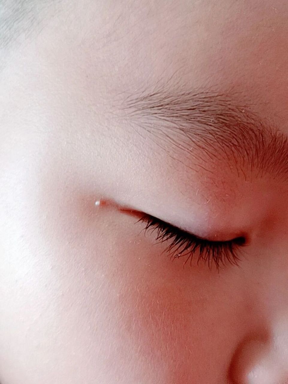 宝宝脸上有个小白点 各位宝妈知道怎么回事 长了好久了 一直没下去 也