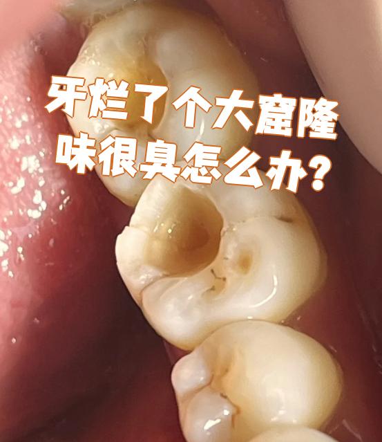为什么牙臭