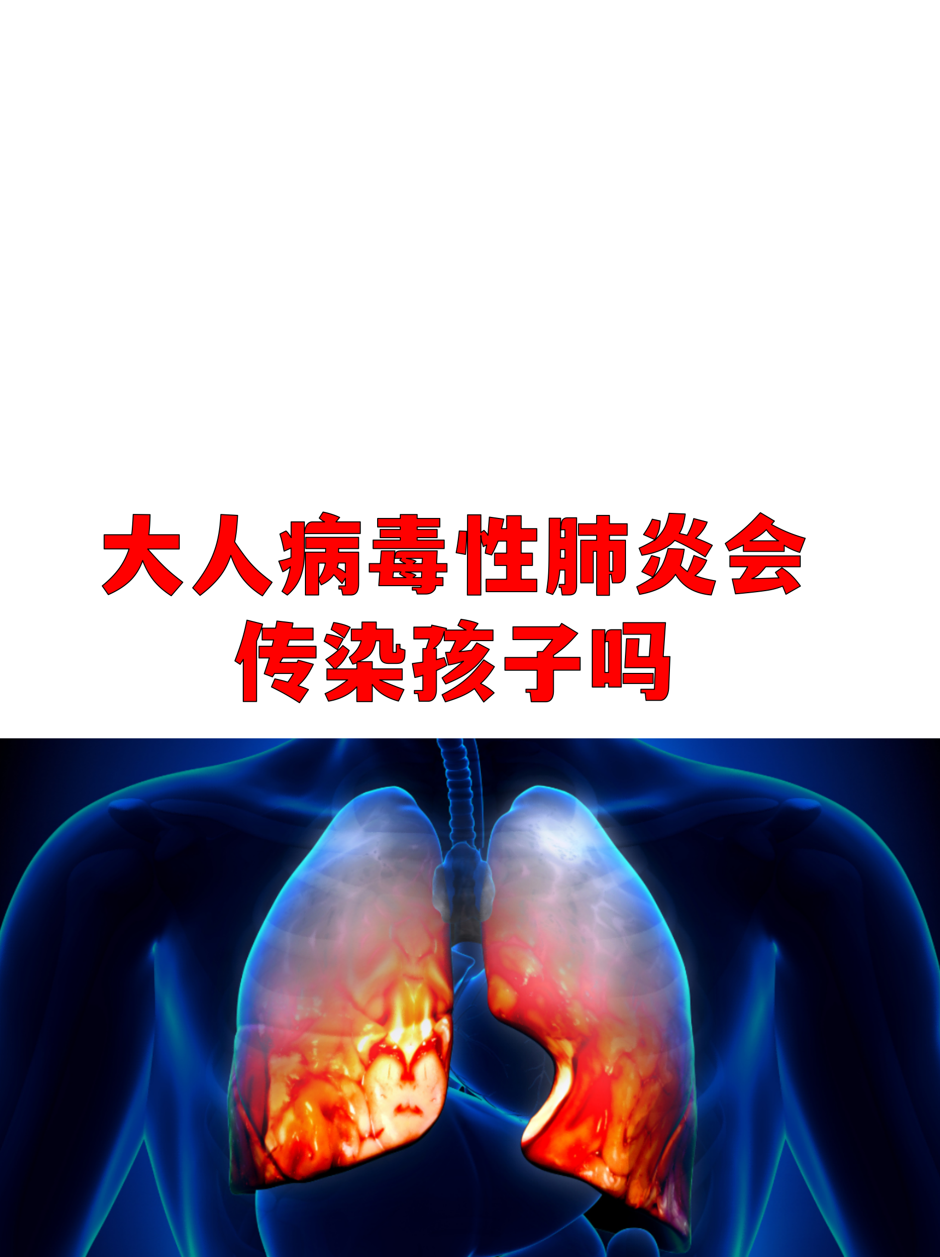  广东近期传染病毒有哪些病毒感染(最近广东有什么病毒)