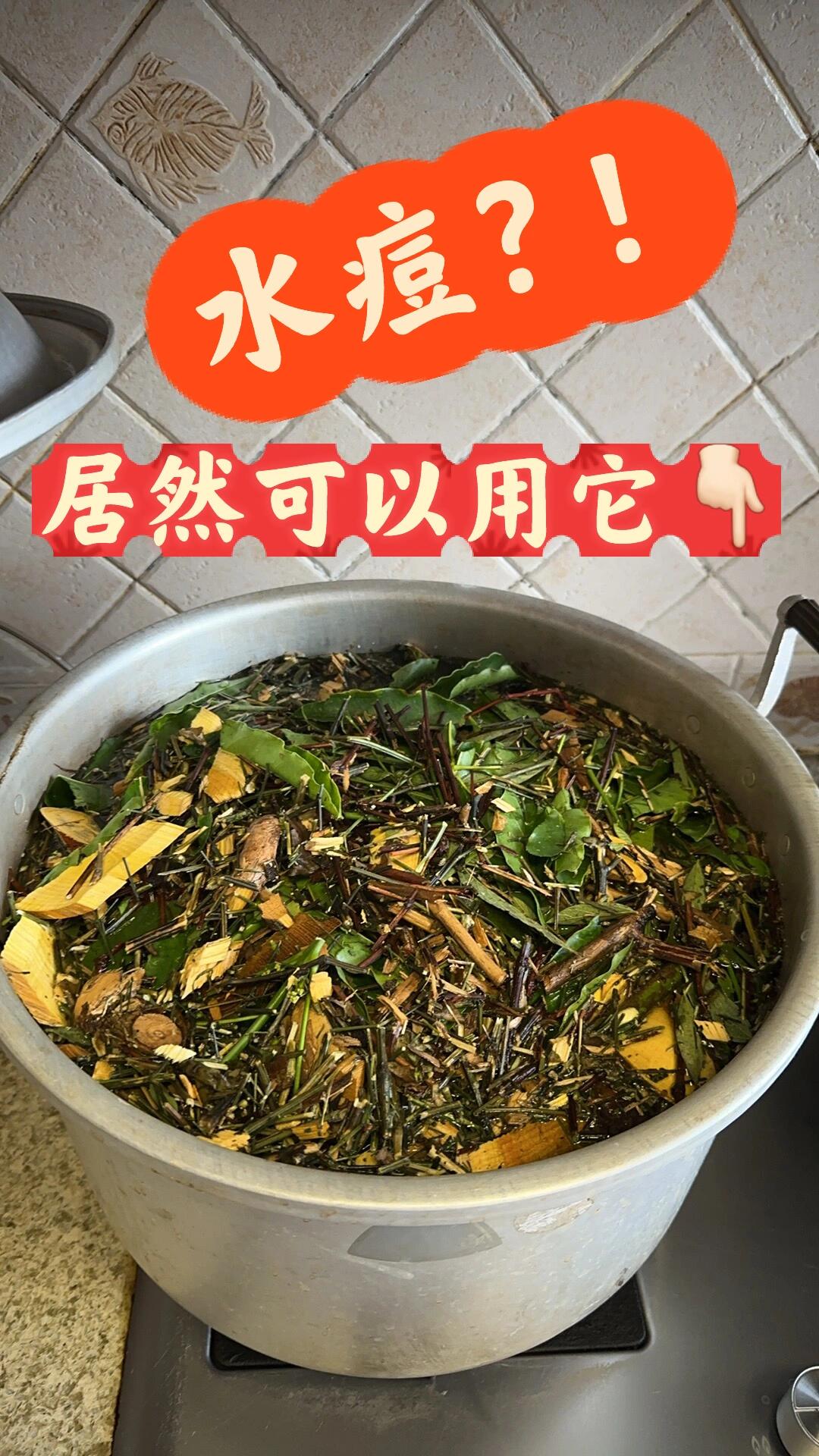 长水痘用木豆树,广西人的土方7815699778156997 从小