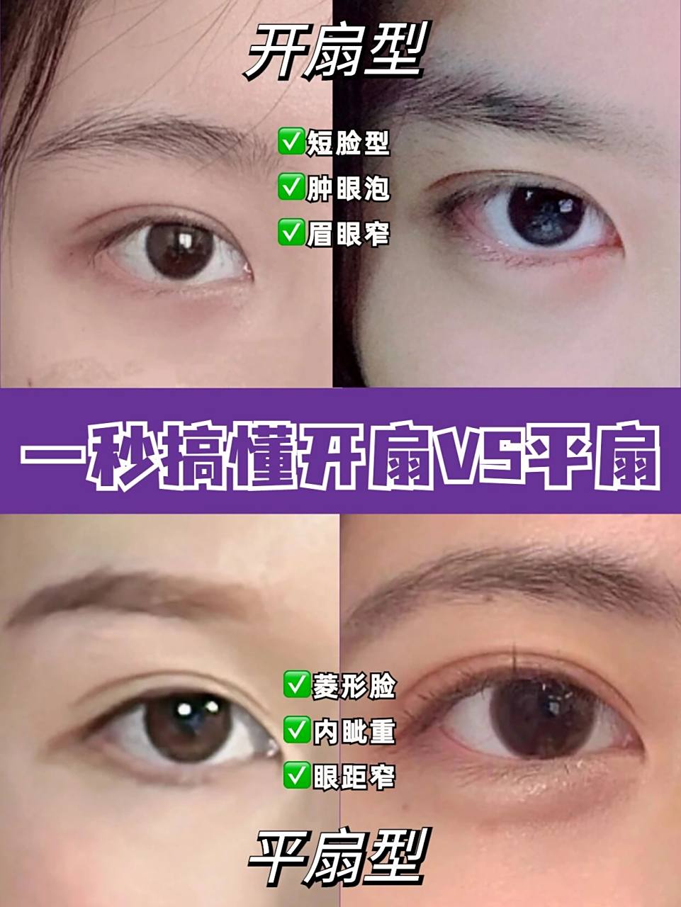 一秒搞懂开扇&平扇 来选个适合自己的双眼皮 平扇与开扇十分相似,最大