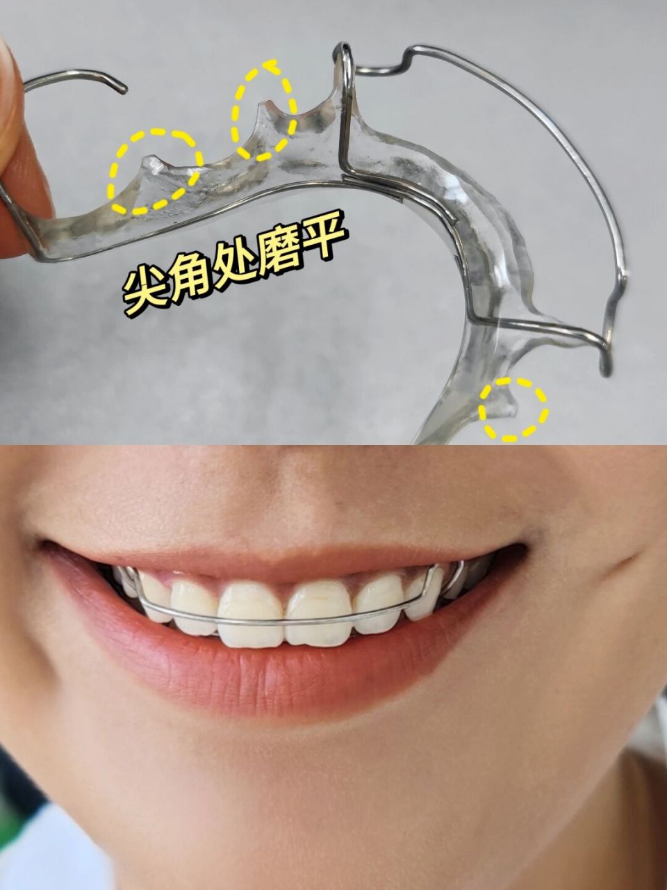 哈雷保持器,需要注意的小细节 看人家带哈雷,感觉很帅气, 只怪当时太