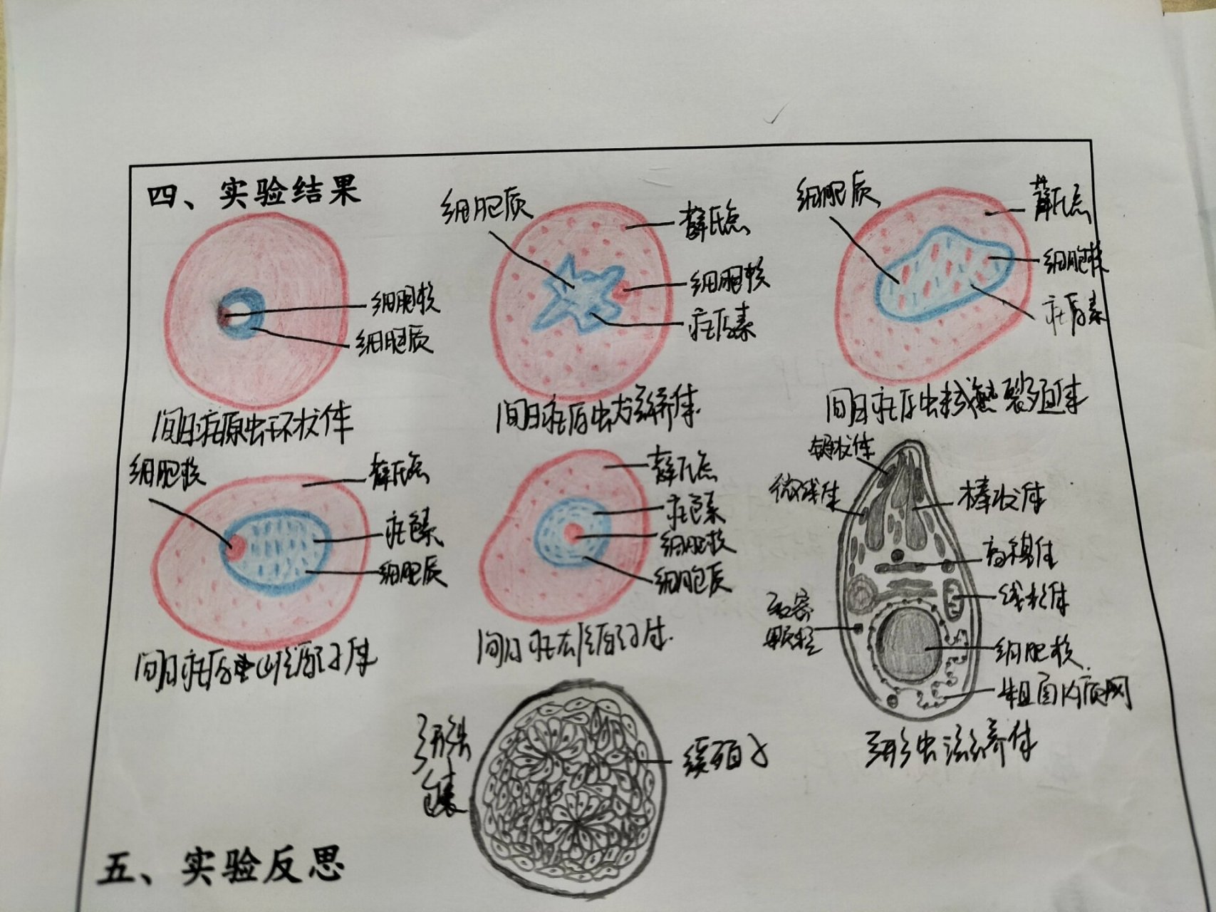 医学生寄生虫学 孢子虫,纤毛虫七类手绘图 间日疟原虫环状体 间日
