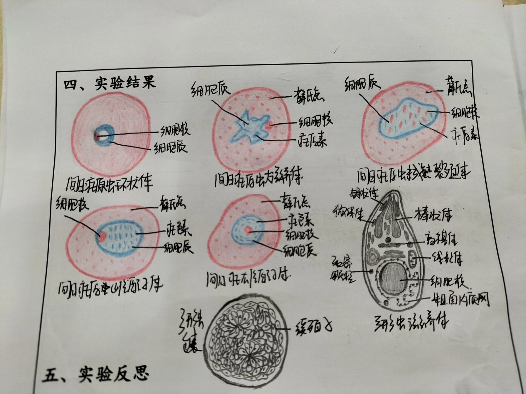 疟原虫小滋养体手绘图图片