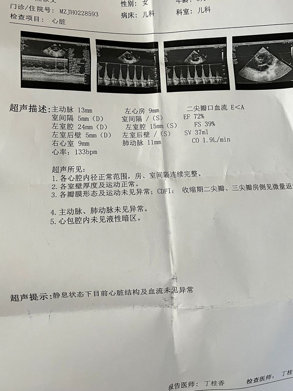 心脏彩超复查卵圆孔闭合 月子里在医院检查出卵圆孔未闭,(2.
