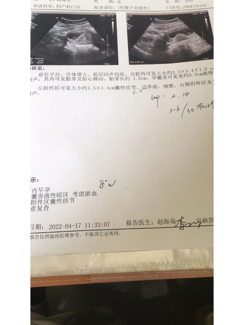 8周了,大家看孕囊猜男孩还是女孩吧