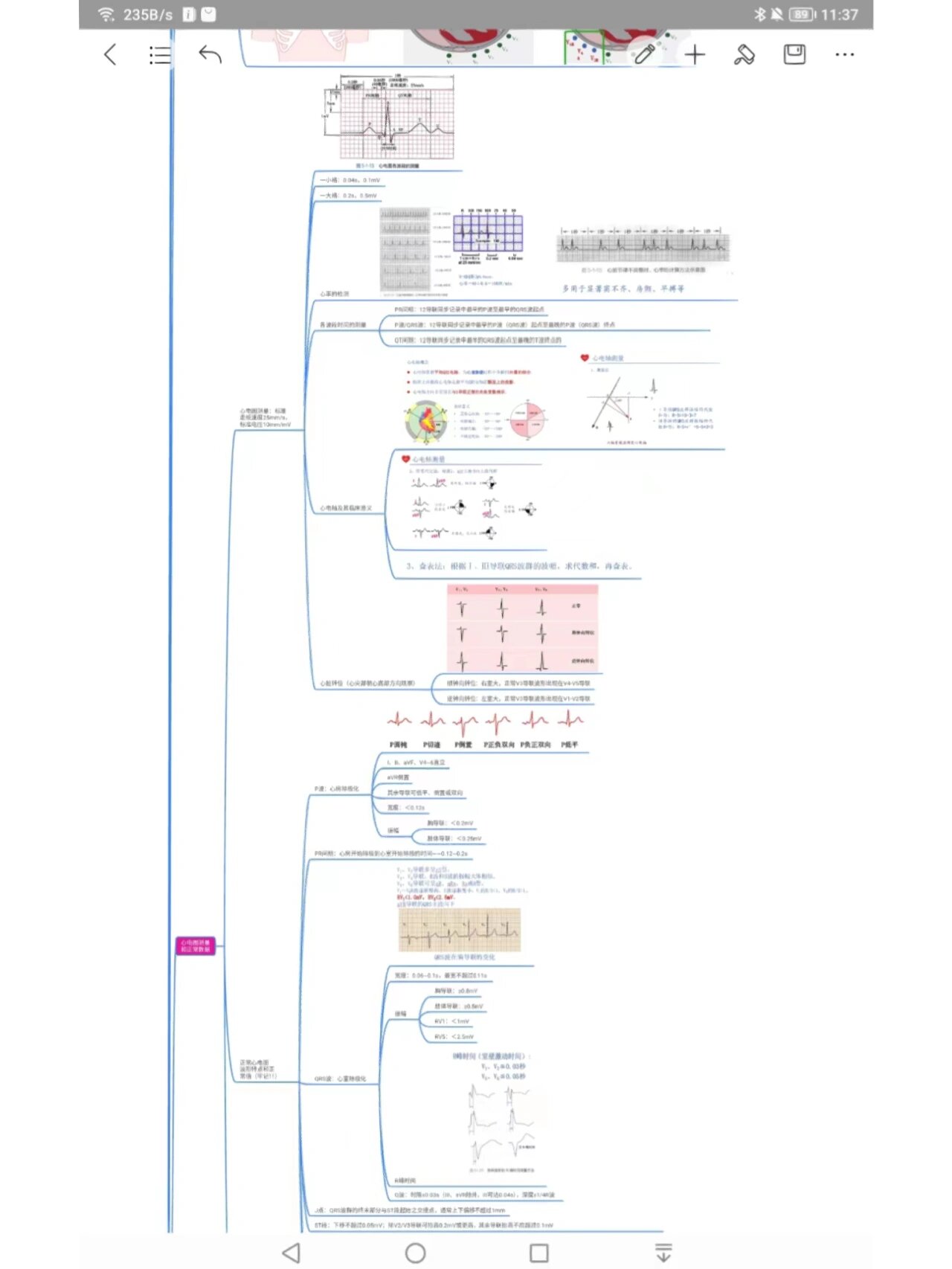 诊断学——辅助检查心电图及常见疾病 73诊断学 心电图检查 思维导