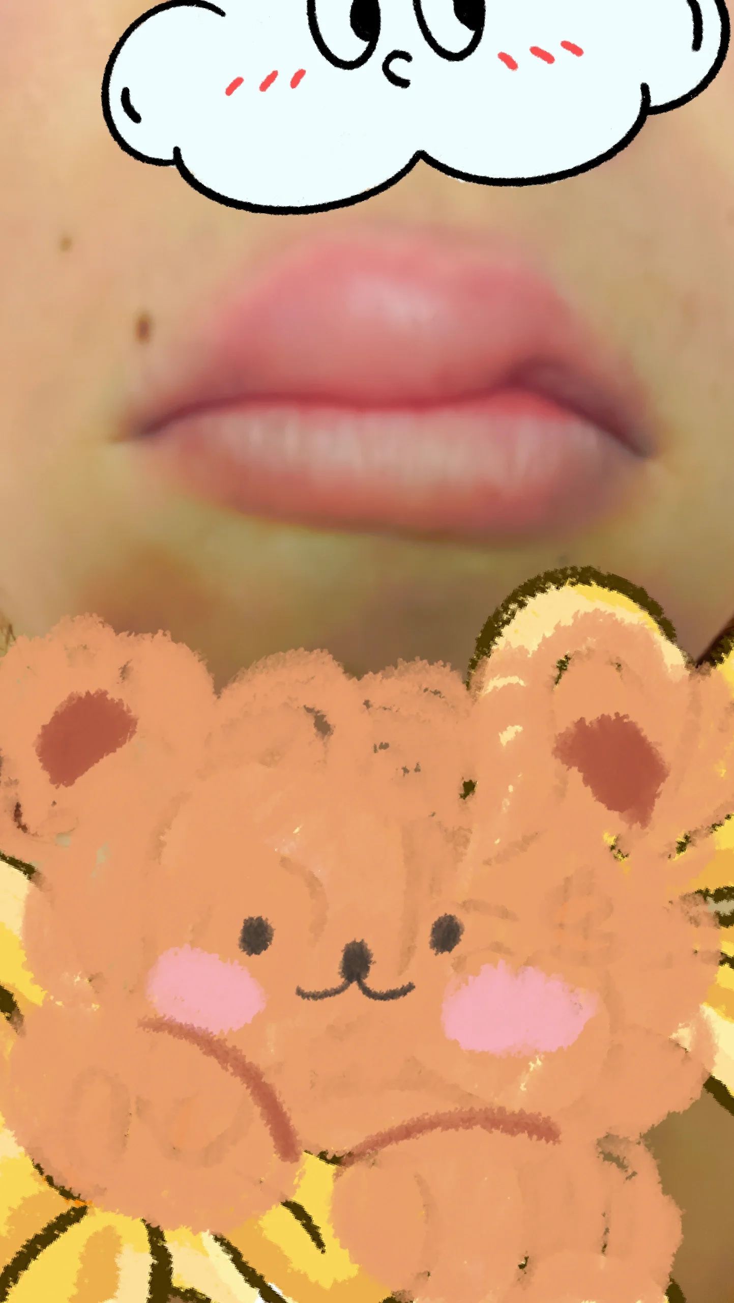 嘴巴为什么会肿 嘴巴为什么会肿