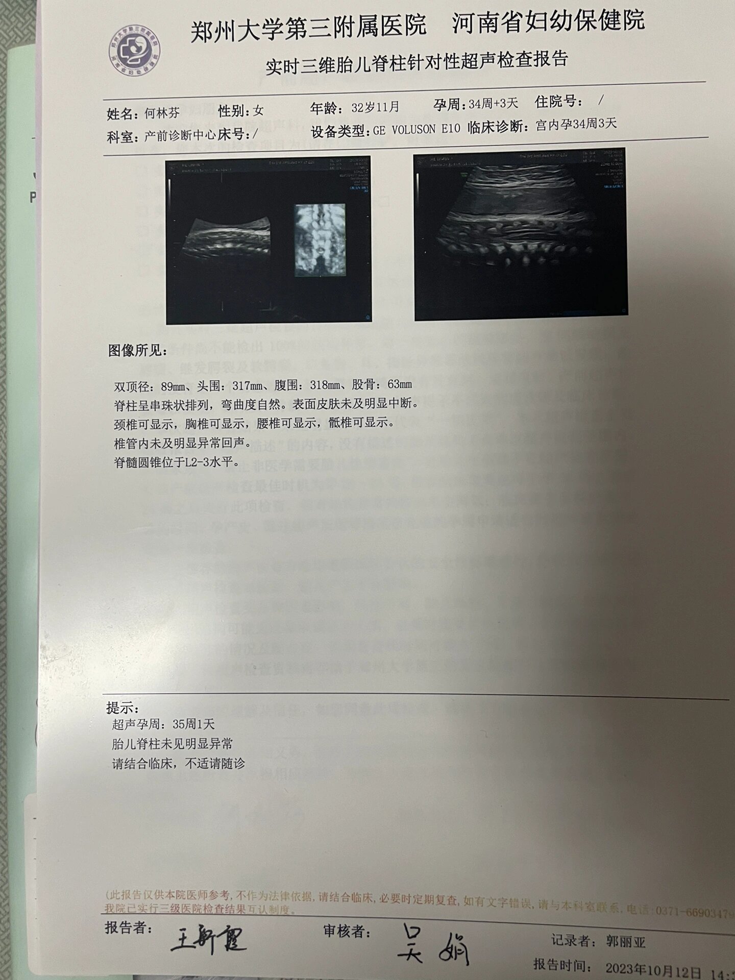 脊髓圆锥低位不要担心,相信宝宝 从22周的l4,到34周的l2-l3,宝宝可以