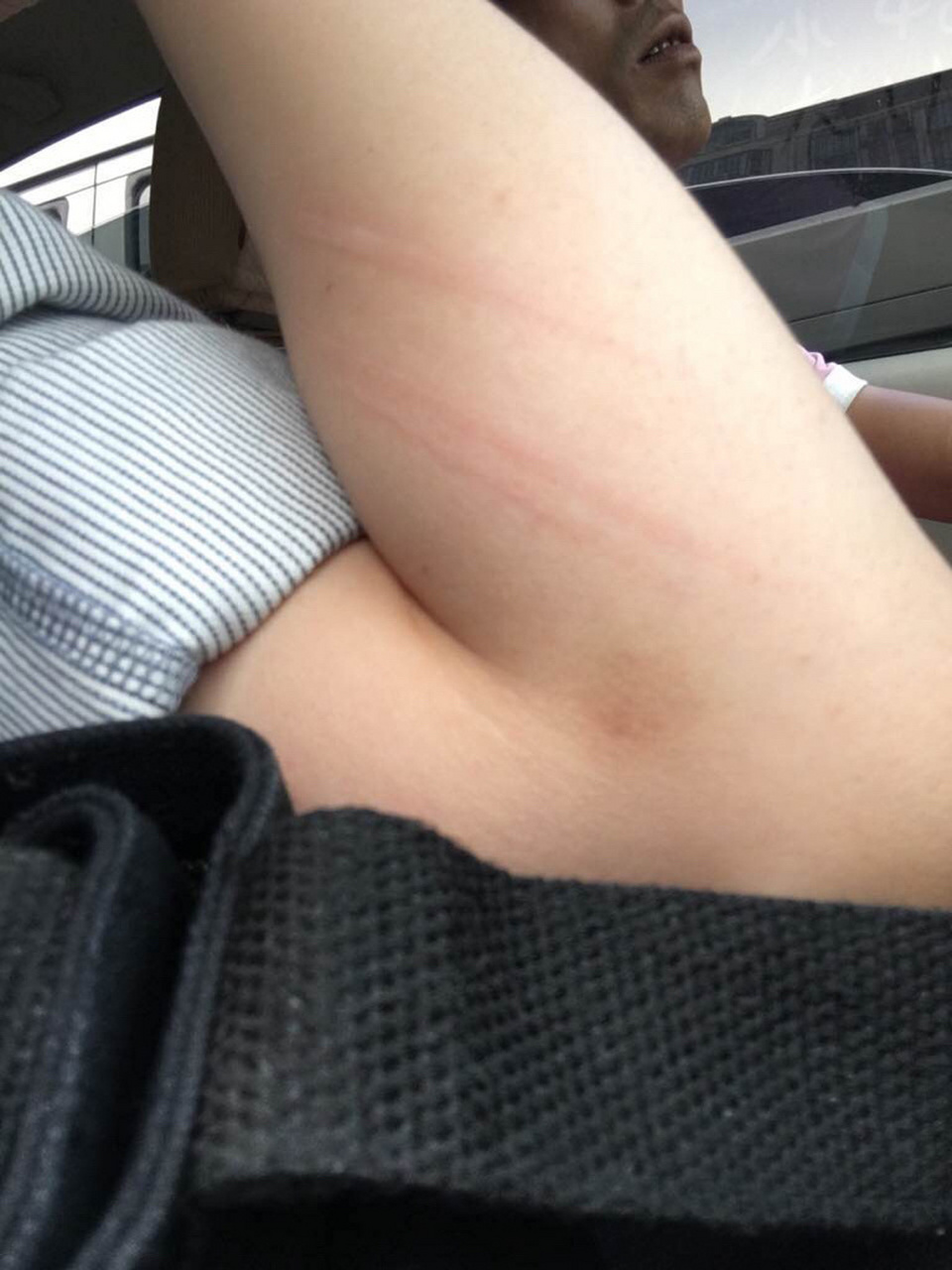 如何分辨狗狗的抓痕还是其他锋利物的割痕 很多家庭有狗狗也有小孩,很