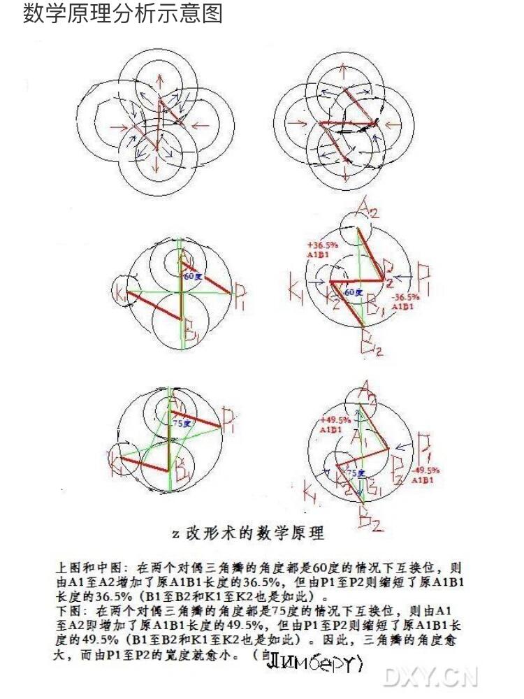 z字成形术图解图片