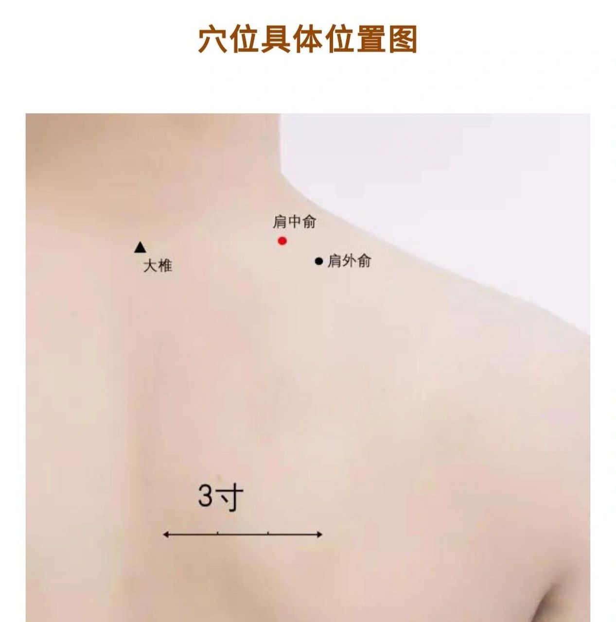 肩中俞穴可预防 咳嗽 肩背酸疼