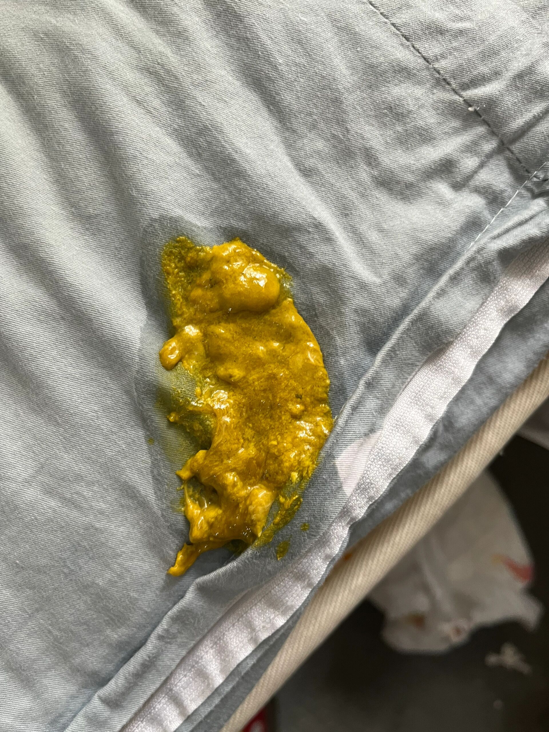 九个月的宝宝 一天拉三次正常吗 宝宝之前大便一天一次 ,就是从5月2号