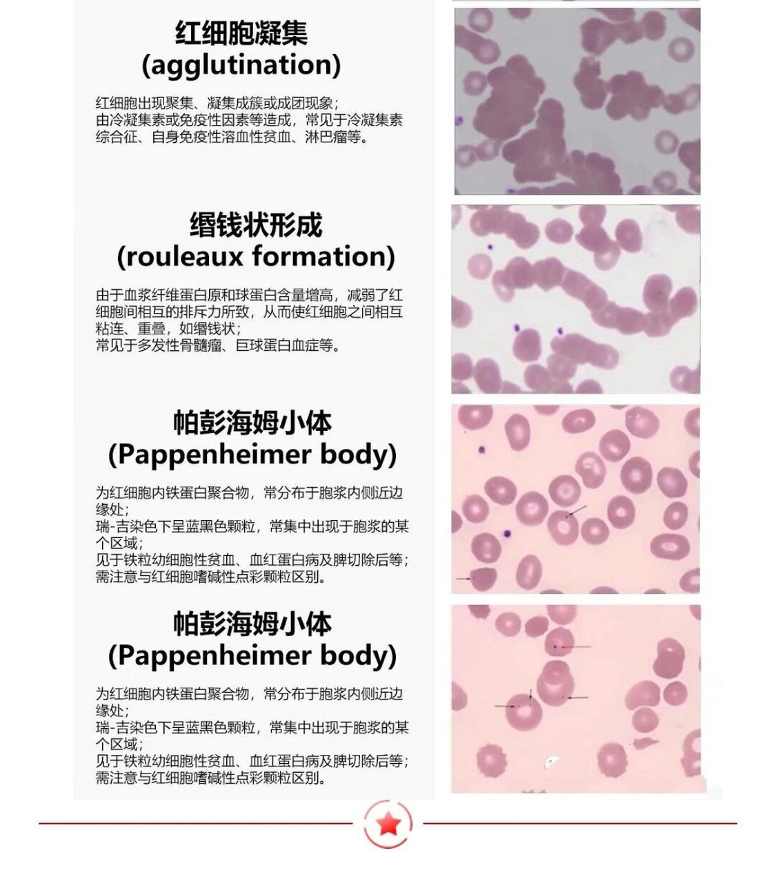 红细胞形态(正常,异常) 97红细胞形态知多少? 97进来学习