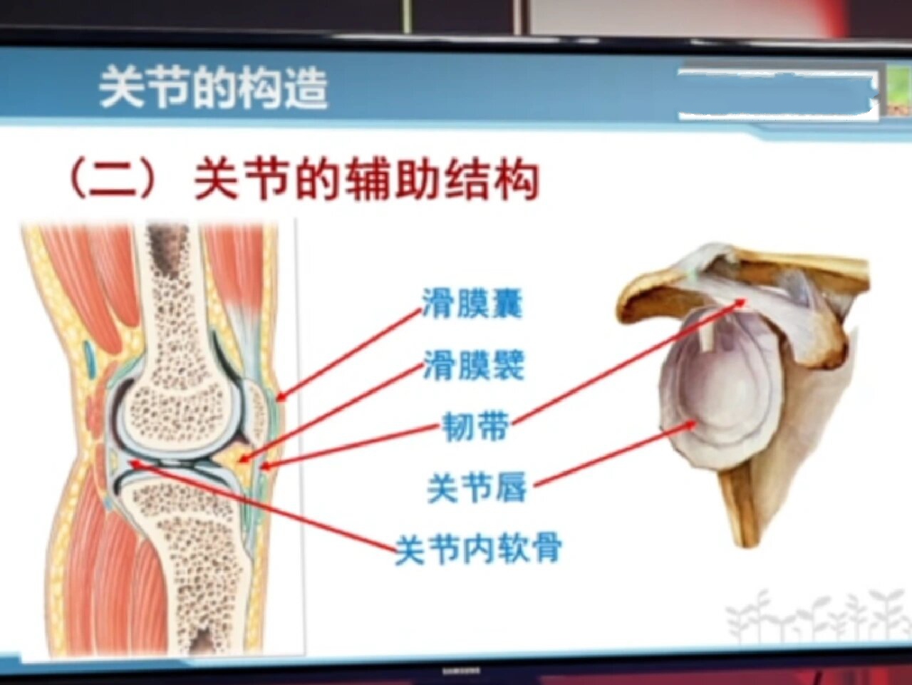 关节腔位置图图片