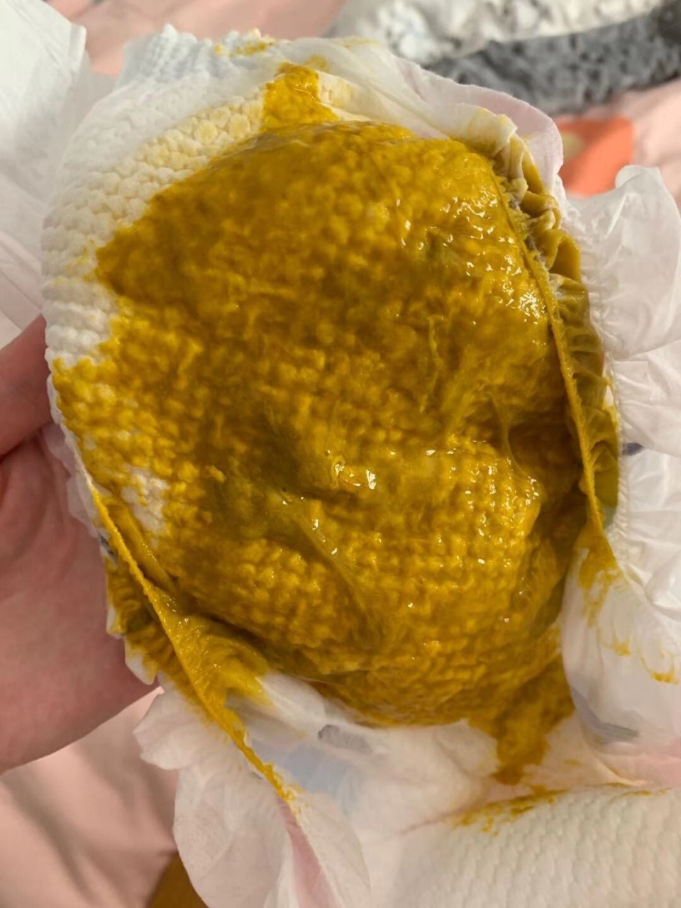 母乳宝宝有粘液很正常,不同干预.