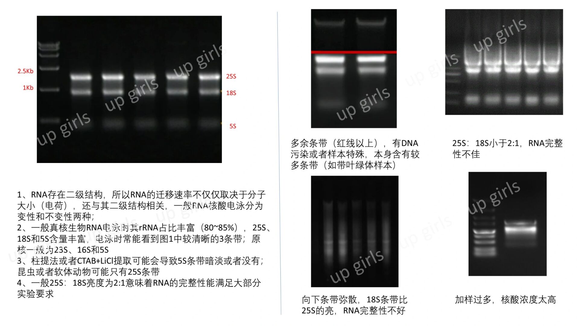 rna电泳图中的三条条带图片