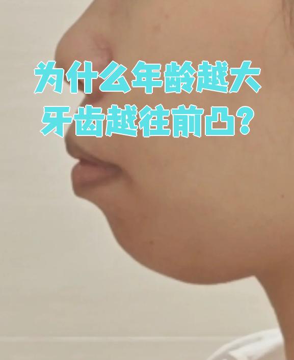 为什么年龄越大牙齿越往前凸?