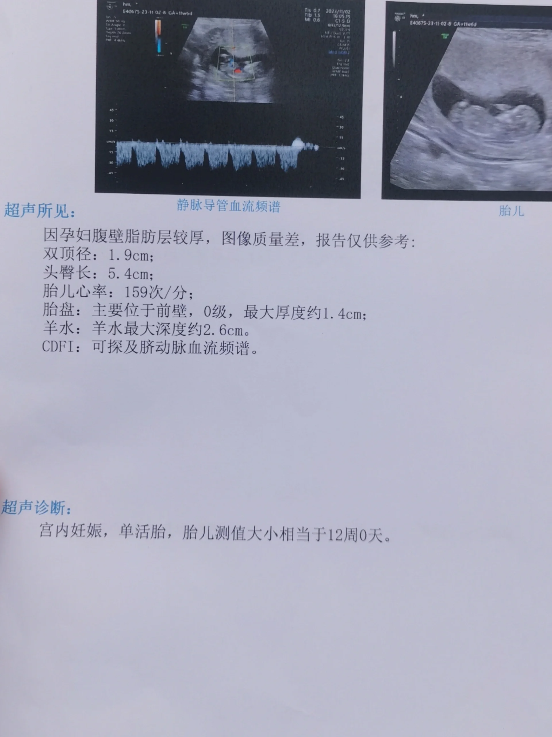 12周nt过啦