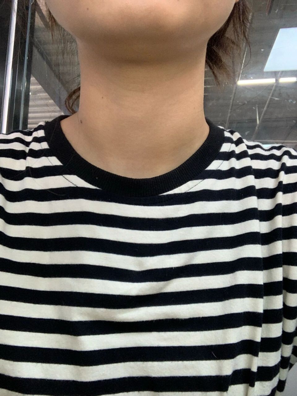 问我是不是有甲状腺问题 姐妹们,这样看我的脖子是不是很粗,是甲状腺