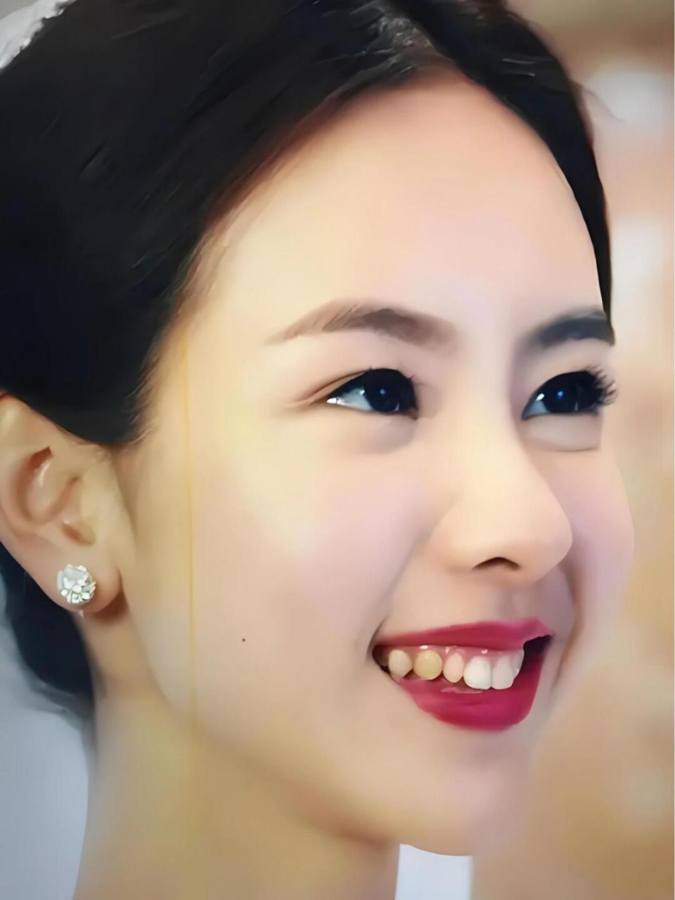 娇娇弱弱,笑容甜美的陈都灵的牙齿居然也有黑历史?