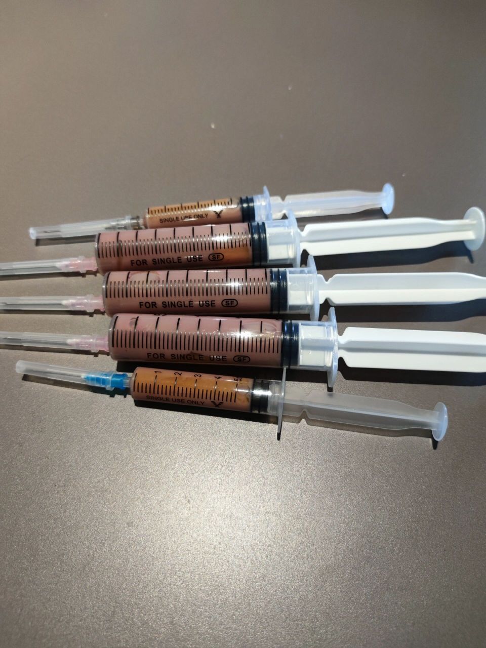 巴氏腺囊肿,这么多,你可以想象一下有多疼 巴氏腺囊肿,这位美女抽出来